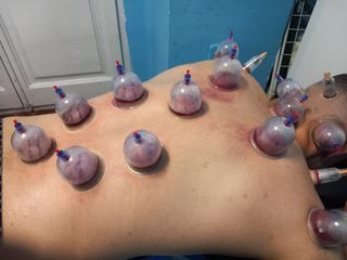 Alhijama