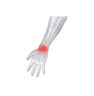 Liga elástica estabilizadora para pulso