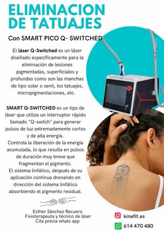 Laser eliminacion de tatuajes y micropigmentacion tattoo