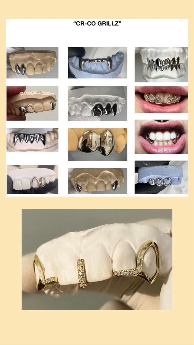Grillz dentales hechos por profesionales