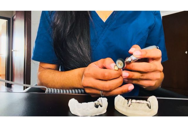 Grillz dentales hechos por profesionales