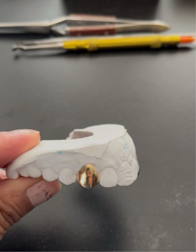 Grillz dentales hechos por profesionales