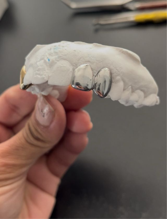 Grillz dentales hechos por profesionales