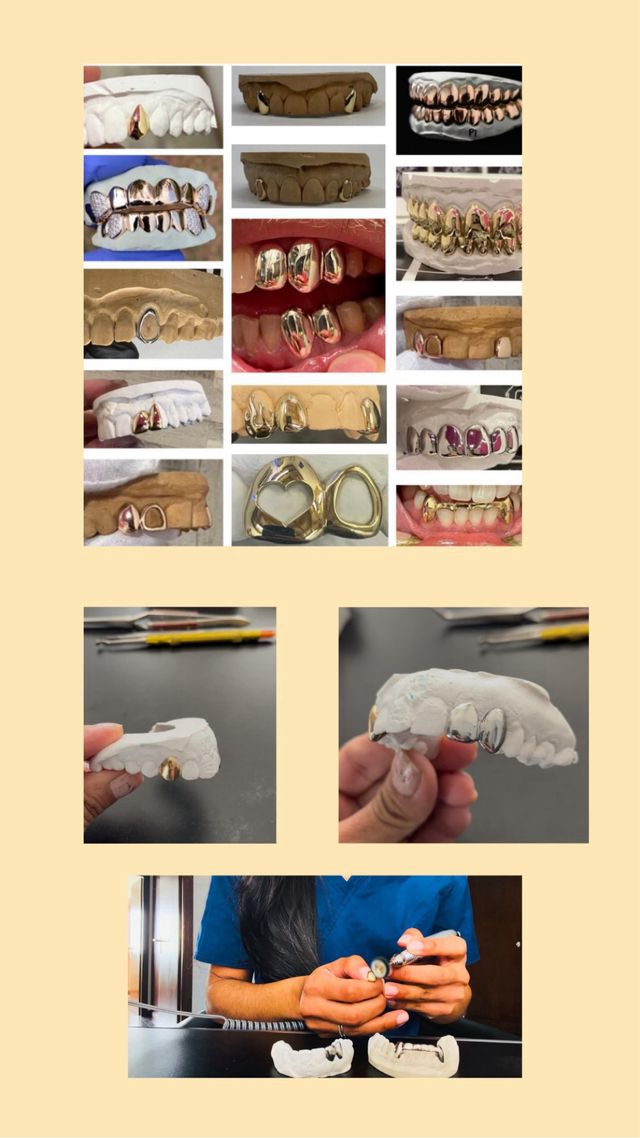 Grillz dentales hechos por profesionales
