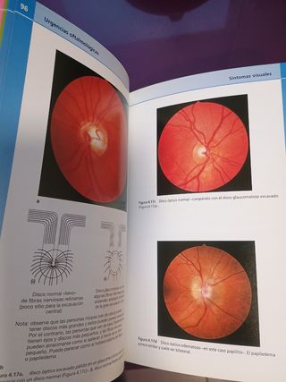 Manual de urgencias oftalmológicas (Spanish Edi...