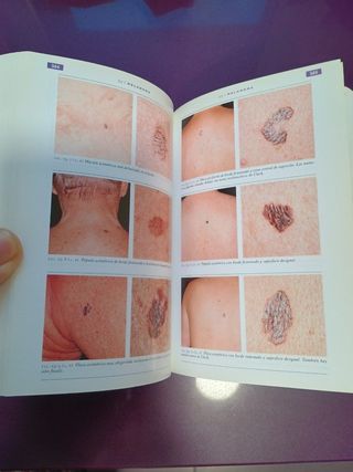 Dermatologia (Spanish Edition)