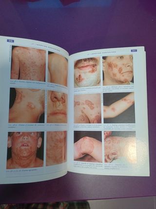 Dermatologia (Spanish Edition)