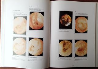 Atlas de Patologia do Ouvido