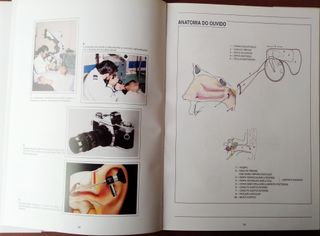 Atlas de Patologia do Ouvido