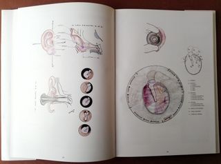 Atlas de Patologia do Ouvido