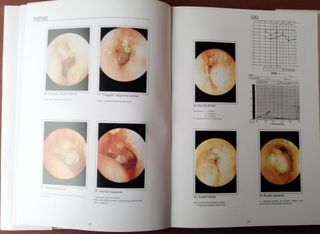 Atlas de Patologia do Ouvido