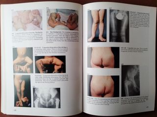 A Colour Atlas of Clinical Orthopaedics