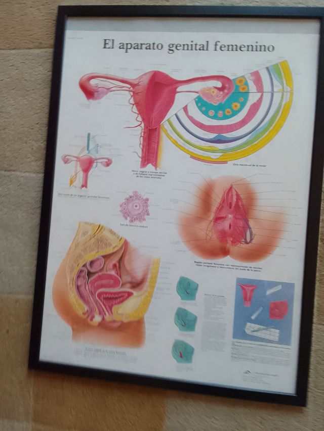 Lámina médica aparato reproductor mujer