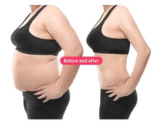 EMS. Ondas Electromagnéticas Focalizadas + RF