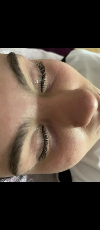 Lifting de cejas y pestañas