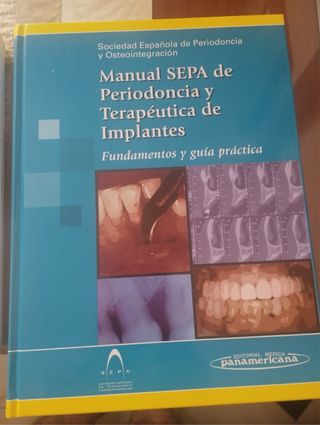 Manual SEPA de Periodoncia y Terapéutica de Implan