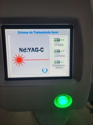Maquila laser de eliminación de tatuajes 