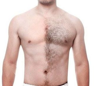 Depilación Corporal para Hombre
