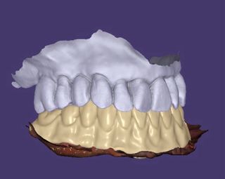 Diseñador Exocad Exocad