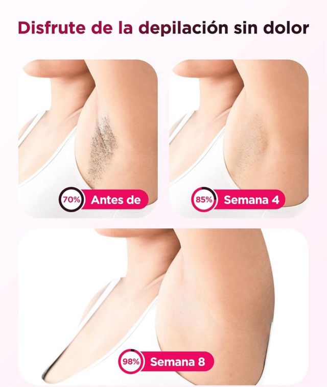 Depiladora IPL Ice-Cool: nueva sin estrenar