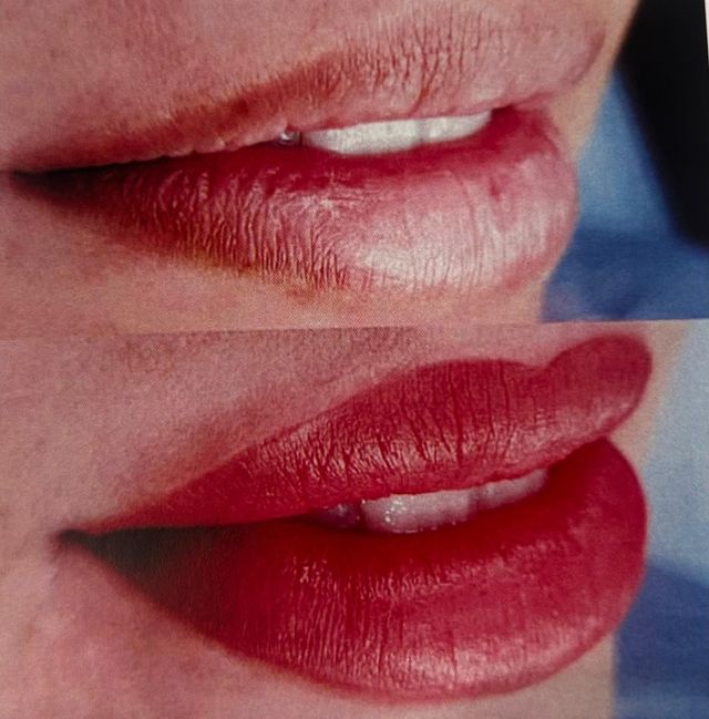 Micropigmentación labios