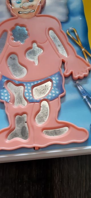 Juego Operación: ¡Qué me pasa, doctor!?