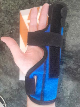 Férula dedos fracturados 4 y 5 metacarpiano