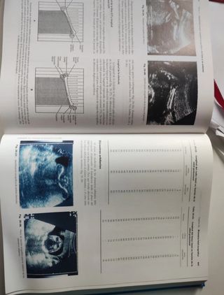 Ecografia En Medicina Materno-Fetal (Spanish Ed...