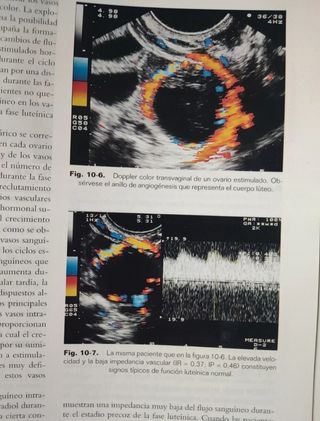 Ecografia En Medicina Materno-Fetal (Spanish Ed...