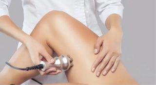 Radiofrecuencia Facial y Corporal