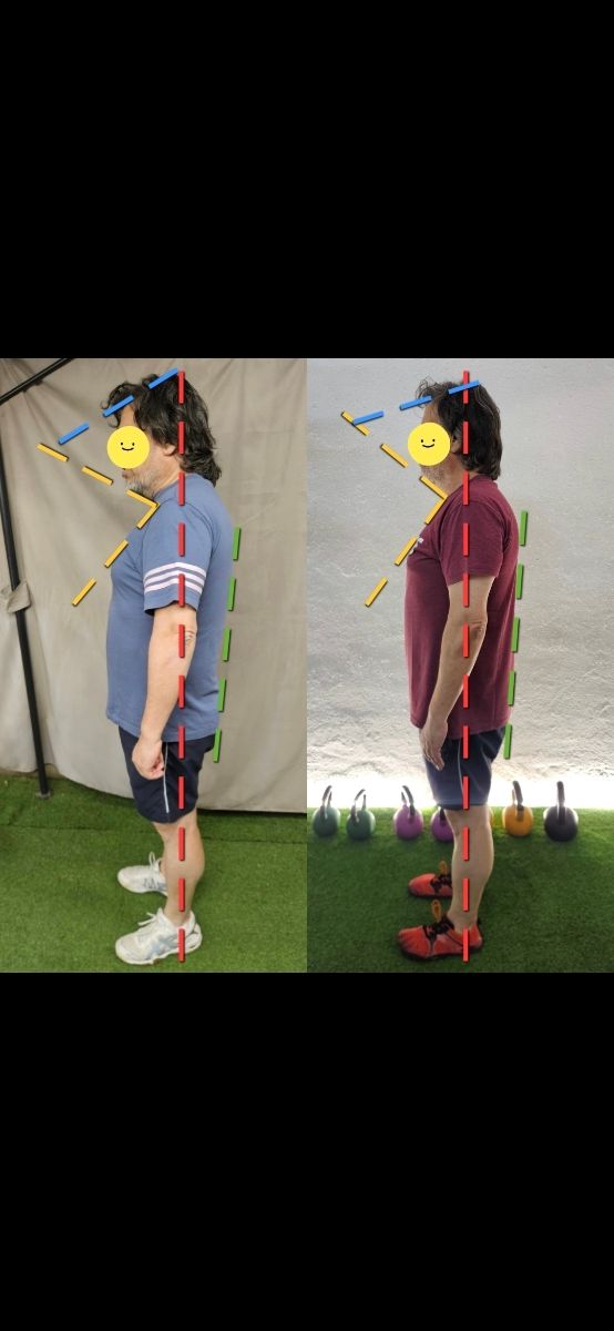 Entrenamiento Personal Torrelodones 