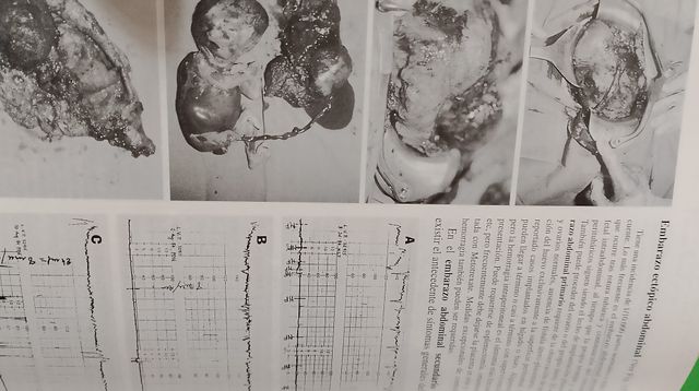 Osbstetricia y Ginecologia (tratado)