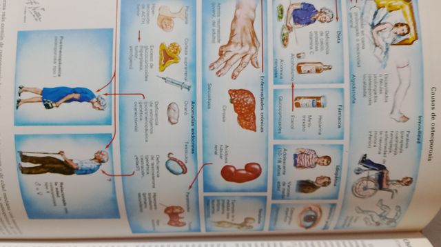 Sistema Musculosqueletico