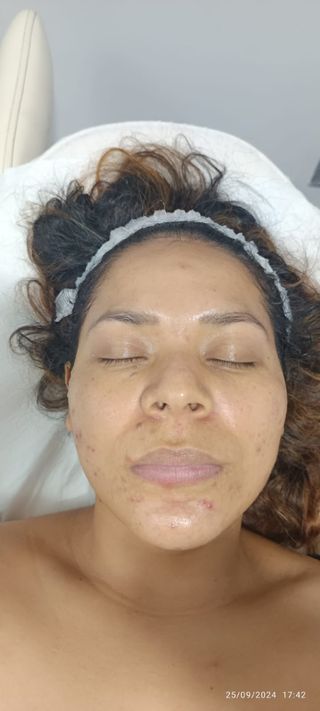 Extension de pestañas. Pelo a pelo.
VERANO 