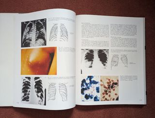 Lote Medicina - Enfermedades Infecciosas