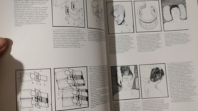 Tratamiento Practico de Fracturas