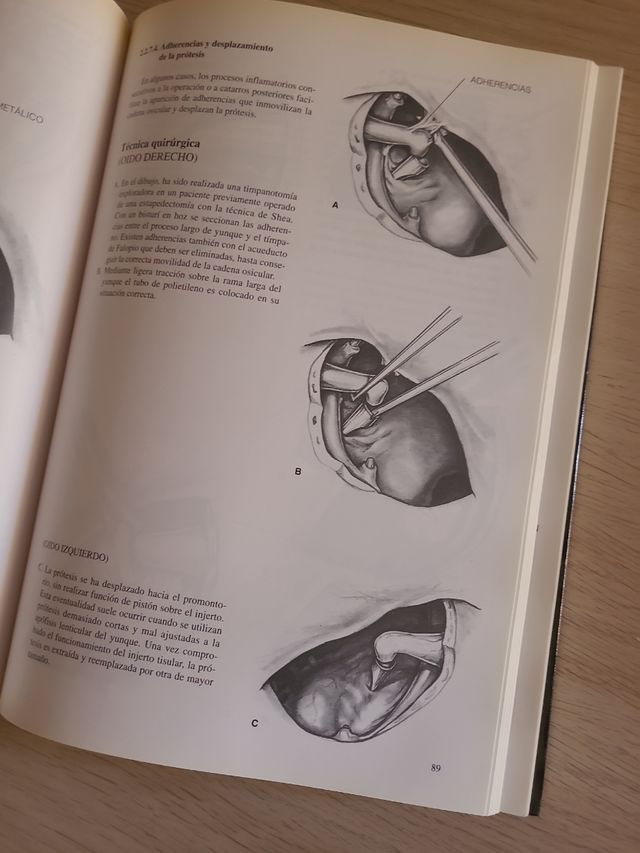 Atlas De Cirugía Del Oído