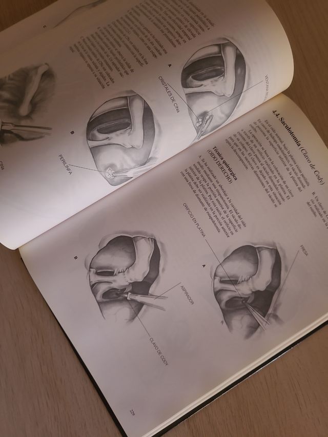 Atlas De Cirugía Del Oído