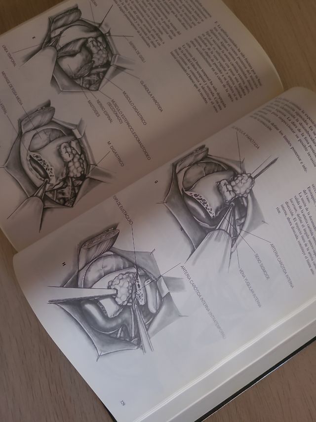 Atlas De Cirugía Del Oído