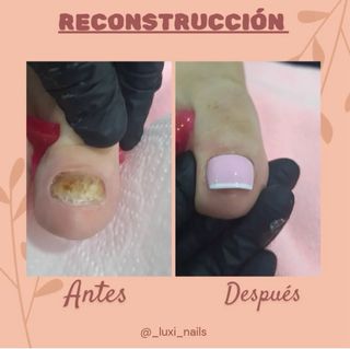 Uñas acrílicas | manicura y pedicura