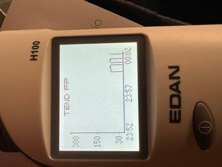 Pulsioximetro de dedo portatil EDAN H100B