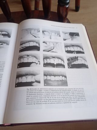 Operatoria Dental: Arte y Ciencia (Spanish Edit...