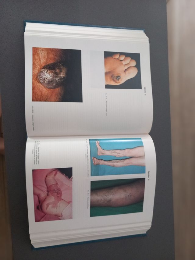 TRATADO DE CIRUGIA. NUEVO. 1342 páginas