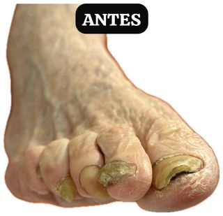 PODOLOGA A DOMICILIO TENERIFE  ZONA METROPOLITANA