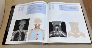 Atlas De Anatomía Humana. Técnicas de imagen médic