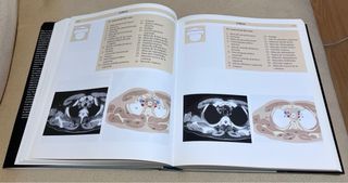 Atlas De Anatomía Humana. Técnicas de imagen médic