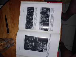 Atlas Anatomía Ecográfica Feto