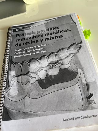 Protesis parcial removible metálicas de resina y 