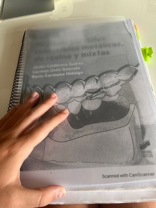 Protesis parcial removible metálicas de resina y 