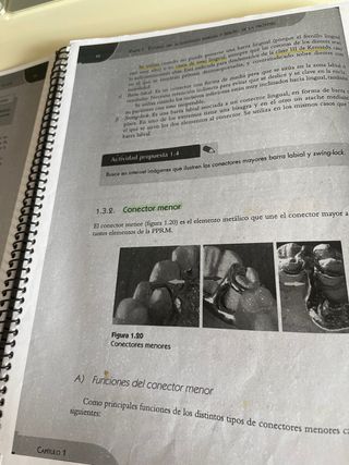 Protesis parcial removible metálicas de resina y 
